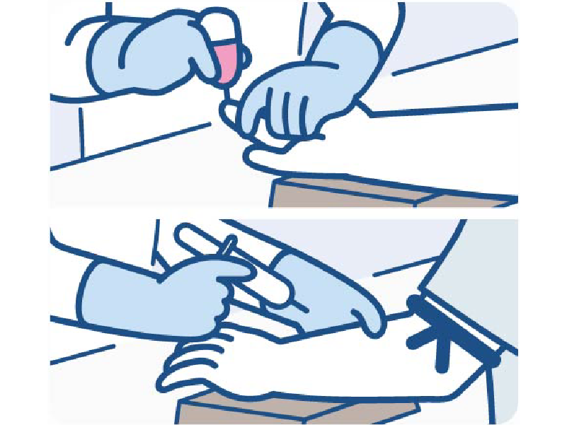 Step1 採血